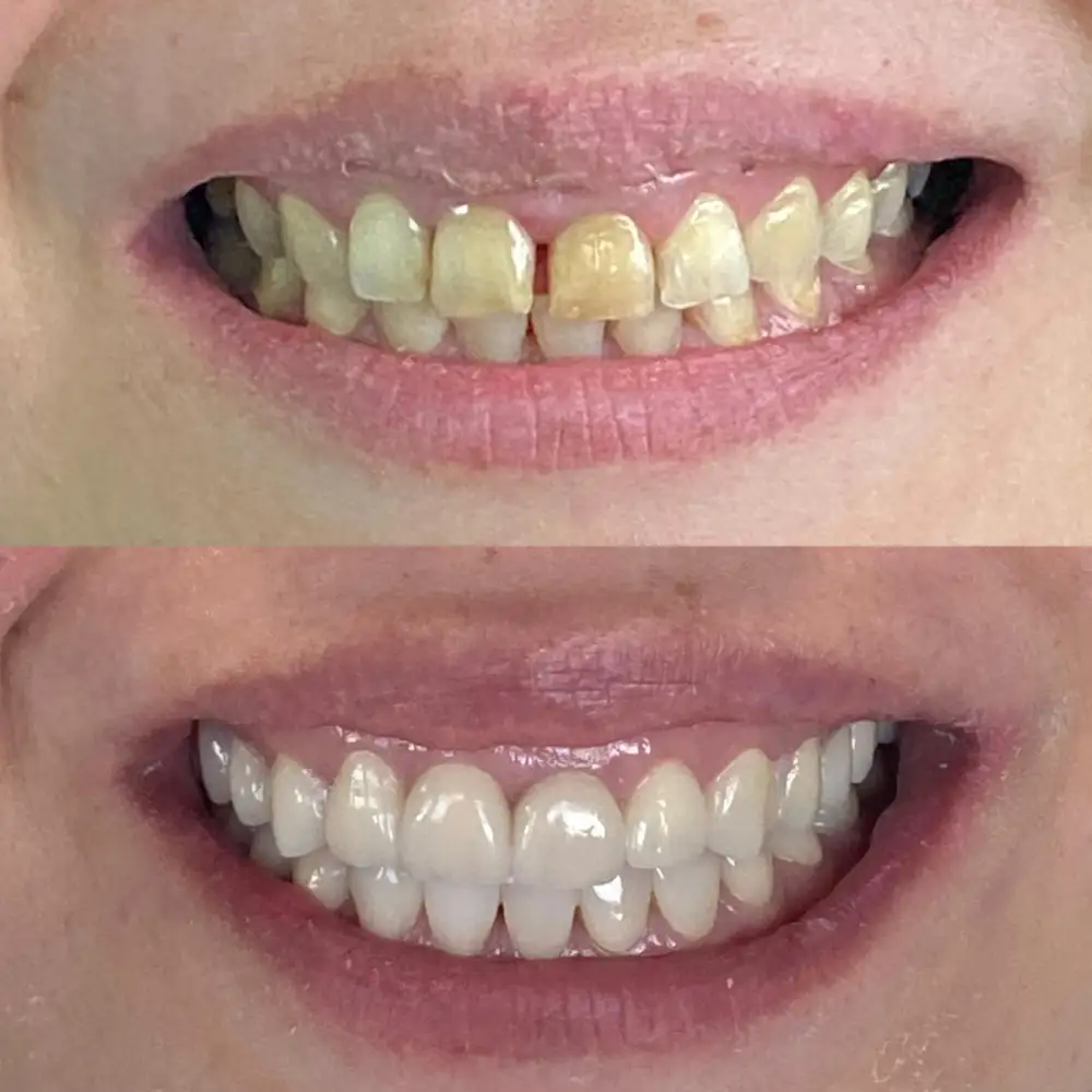 Faceta Dental
