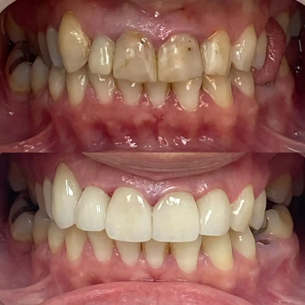 Faceta Dental