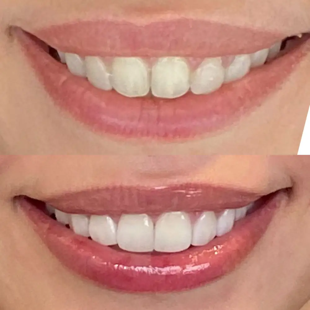 Faceta Dental