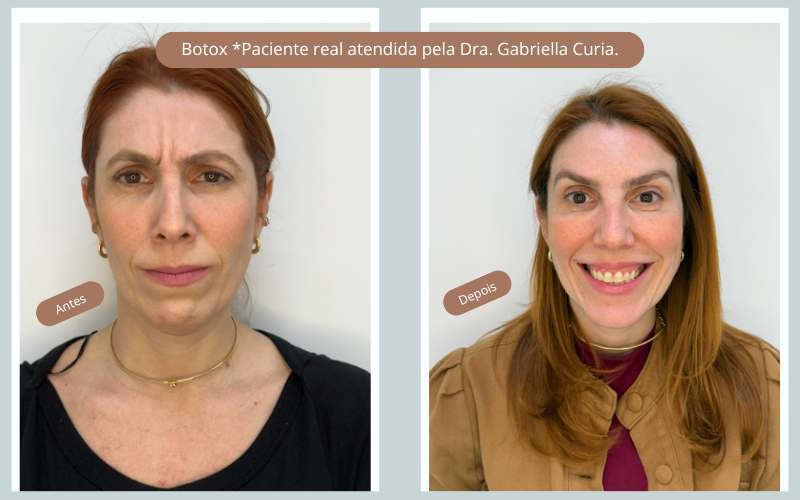 harmonização facial Dra Gabriella Curia